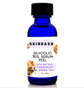 70% Glycolic Acid Serum Peel - with Retinol & Chamomile Green Tea ExtractS (Professional Skin Peel) For Wrinkles, Acne Scars, Fine Lines, Collagen Boost - Anti -Aging Alpha Hydroxy Acid 1oz Bottle